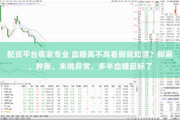   配资平台哪家专业 血糖高不高看脚就知道？脚麻、肿胀、末梢异常，多半血糖超标了